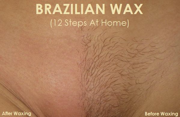 Brazilian wax pictures before and after