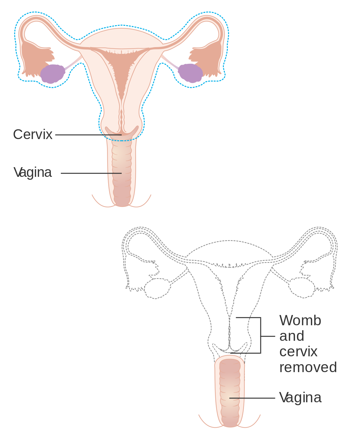 Womb cervix free videos watch download and enjoy womb